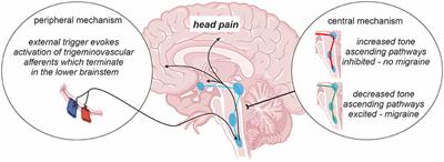 Chronic Migraine Pathophysiology and Treatment: A Review of Current Perspectives